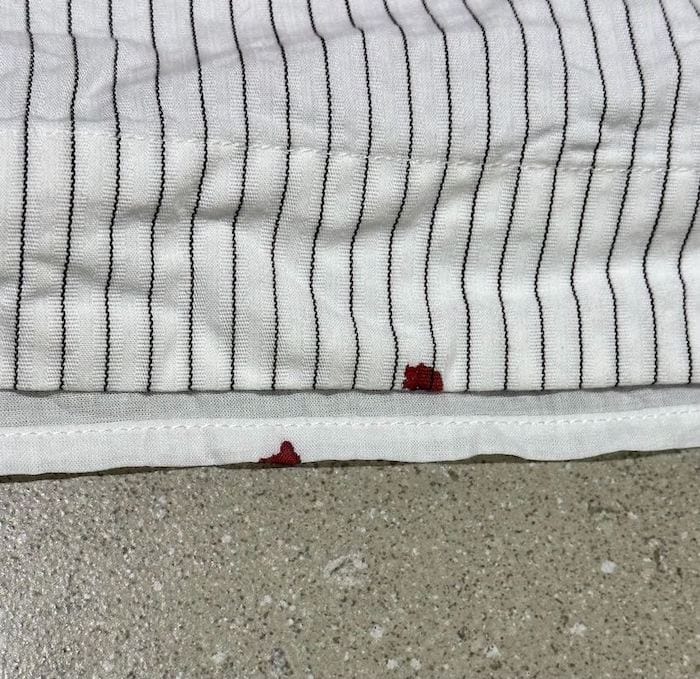 two dried blood stains on clothes